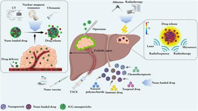 Application of nanotechnology in the treatment of hepatocellular carcinoma